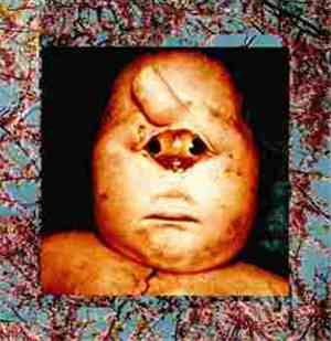 Fetus Productions - Fetus ReProductions
