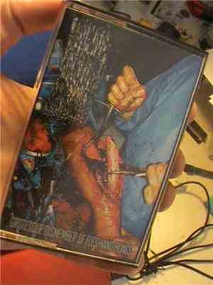 Postmortem Neurofetish Bionecrosis - Grotesque Dismember Of Flesh And Bones
