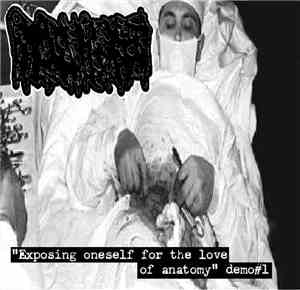Hydrocephalus - Exposing Oneself For The Love Of Anatomy