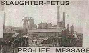 Slaughter-Fetus - Pro-Life Message
