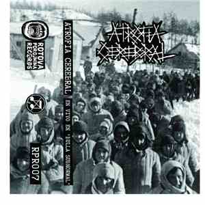 Atrofia Cerebral - Bulla Subnormal