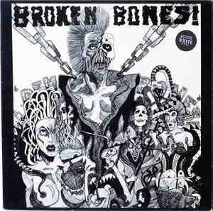 Broken Bones - Dem Bones