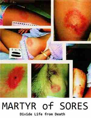 Martyr Of Sores - Divide Life From Death