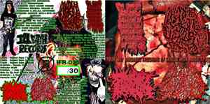 Coagulated Anorectal Hemorrhage / RxMxHxFxTxVxOx / Child Rapist / Cake Fart Prolapse - Four Way Barbaric Crushing Of Skulls With Noise