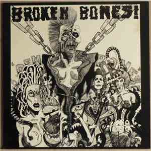Broken Bones! - Dem Bones