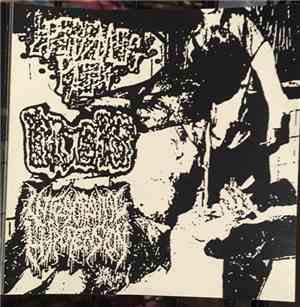 Epidemic Pain - Urachus - Intracranial Hypotension - Epidemic Pain-Urachus-Intracranial Hypotension