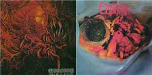 Carnage  / Cadaver - Dark Recollections / Hallucinating Anxiety