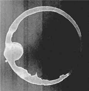 Maskros, Kaji , Astrid , This Too Will Pass, A City Sorrow Built - 5-Way-Split