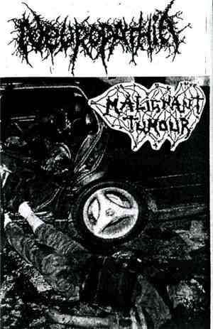 Malignant Tumour / Neuropathia - Split Tape