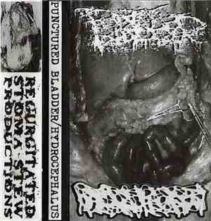 Punctured Bladder, Hydrocephalus - Split Cassette