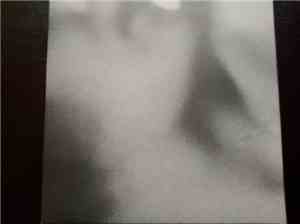 L'Eix - 