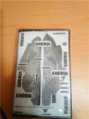 Anemia  - Aggregation Of Red Blood Cells Session #1