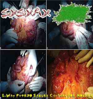 SxSxAx / DxTxS - 2​-​Way Pútrido Sangre Causada Por Monera