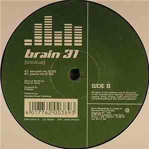 Brain 31 - Tinnitus
