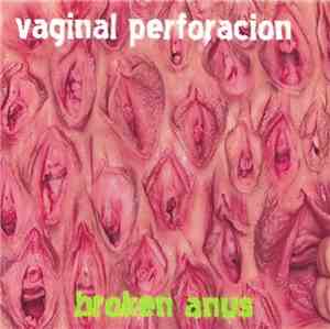 Vaginal Perforacion - Broken Anus