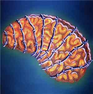 Various - Brain In The Wire - Disc A