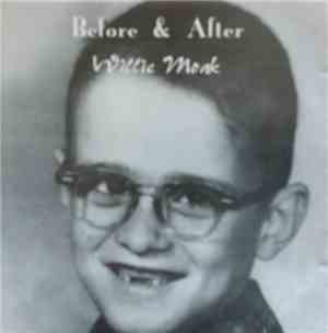 Willie Moak - Before & After