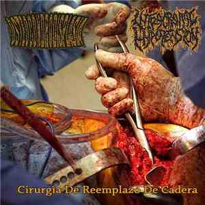Intracranial Hypotension / Osteocondrodisplasia - Cirurgia De Reemplazo De Cadera