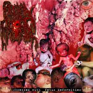 Rectal Prolapse - Obsessed With Fetus Deformities